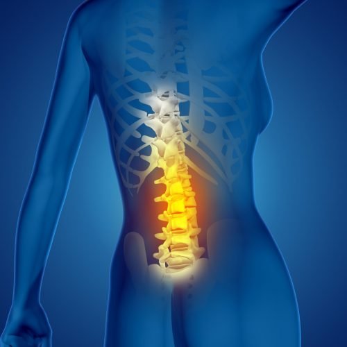 3D render of a female medical figure with spine highlighted